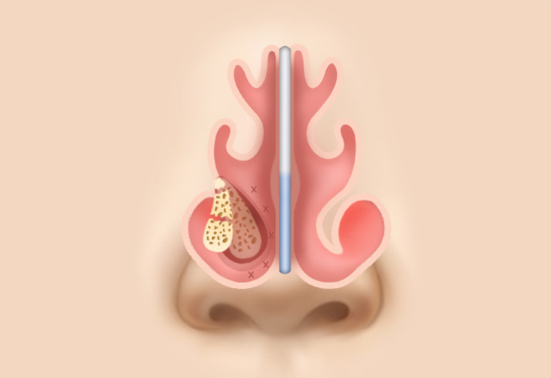 Functional Diagnosis