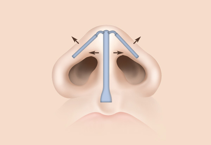 Functional Stabilization
